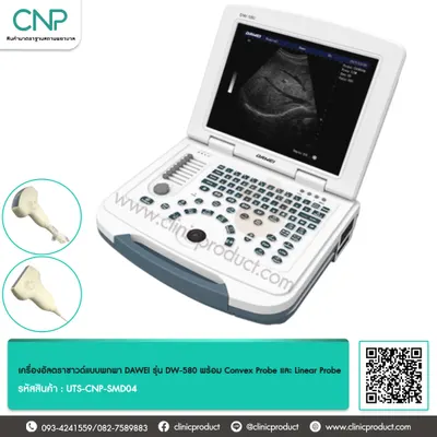 เครื่องอัลตราซาวด์แบบพกพา DAWEI รุ่น DW-580 พร้อม Convex Probe และ Linear Probe