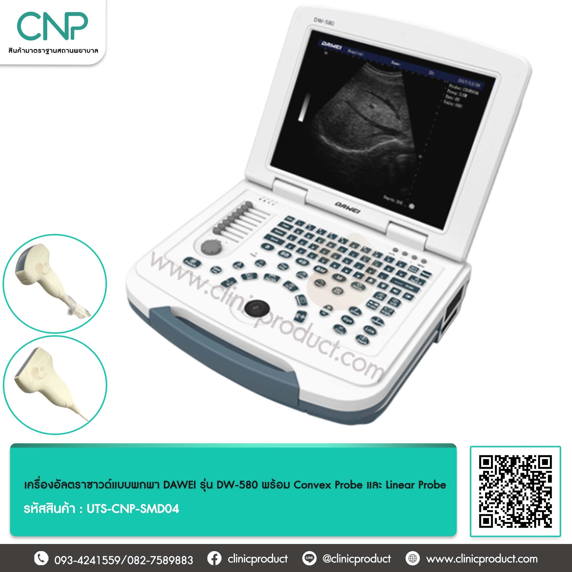 เครื่องอัลตราซาวด์แบบพกพา DAWEI รุ่น DW-580 พร้อม Convex Probe และ Linear Probe