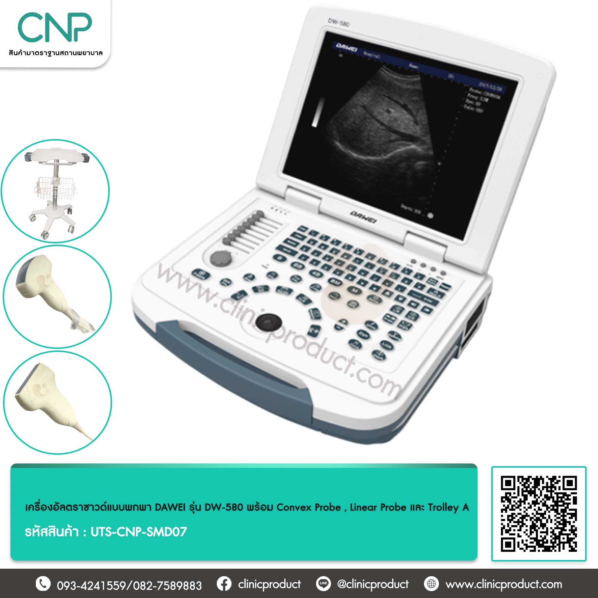 เครื่องอัลตราซาวด์แบบพกพา DAWEI รุ่น DW-580 พร้อม Convex Probe , Linear Probe และ Trolley A