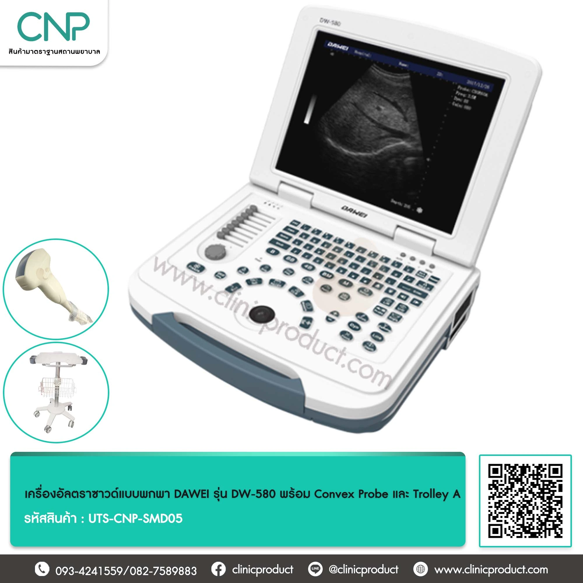 เครื่องอัลตราซาวด์แบบพกพา DAWEI รุ่น DW-580 พร้อม Convex Probe และ Trolley A
